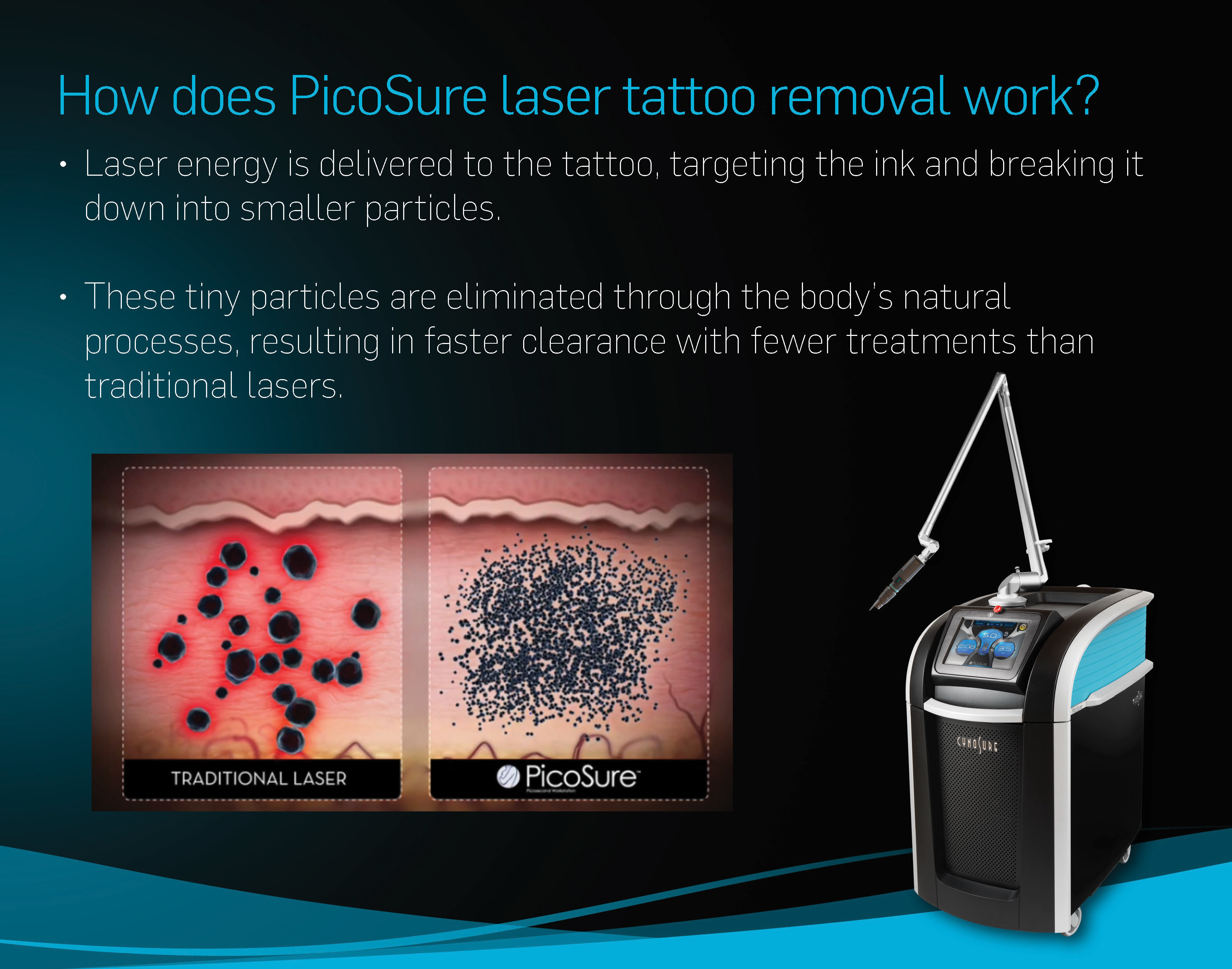 China Long Pulse Nd Yag Laser Picosecond Laser Tattoo Removal Machine Ce Certificated factory