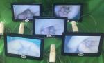 Digital Video Colposcope for Woman Care 10 or 7 Inch Medical Monitor Professiona