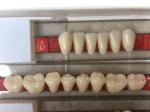 Acrylic Resin Denture Teeth Set Repair Surfaces 2 Layers Super Hard Synthetic