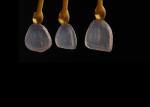 Ultra Thin Ceramic IPS EMAX Veneer Stain Resistance For Esthetic Restorations