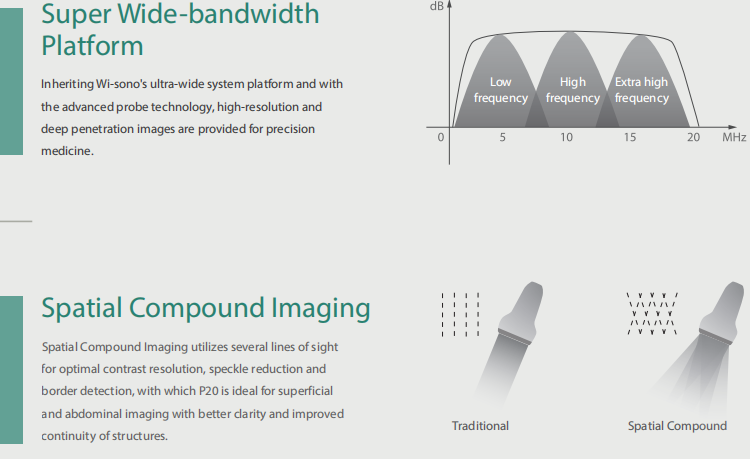 Sonoscape Portable Color Doppler Ultrasound Sonoscape S22 Ultrasound Machine Sonoscape P20 Doppler Ultrasound