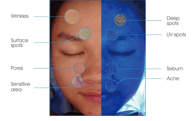 UV Spectrum Skin Hydration Analyzer With High Checking Effectiveness