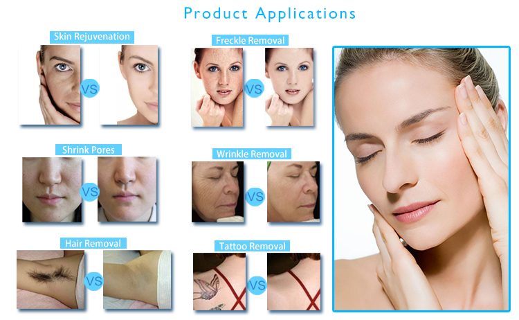 Beauty Center Clinic Salon Machine Factory OPT IPL RF Technology