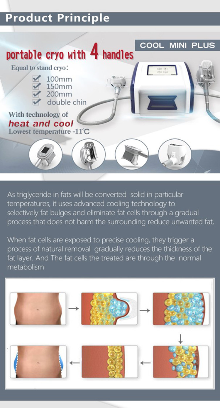 LF-218 portable cryo slimming machine / cryo for fat reduction / cryo slimming device