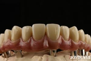 China Titanium Malong Dental Hybrid Bridge Long Lasting Adjusted Fit Low Density factory