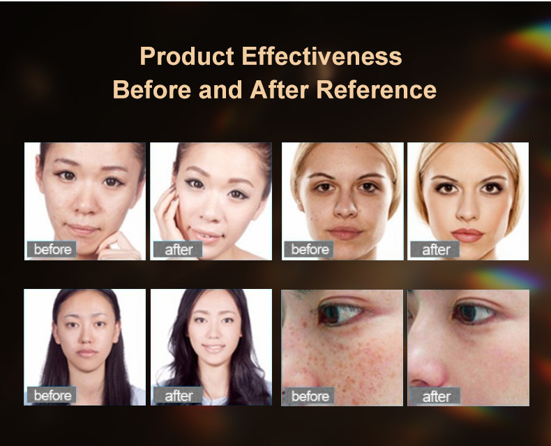 Non Invasive PDT Light Therapy Device 625nm 650nm For Pigment Removal