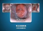 Digital Endoscope Self-Inspect Colposcope Mini Colposcopy with Range of