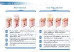 Medical CE approval Best professional IPL beauty hair removal machine