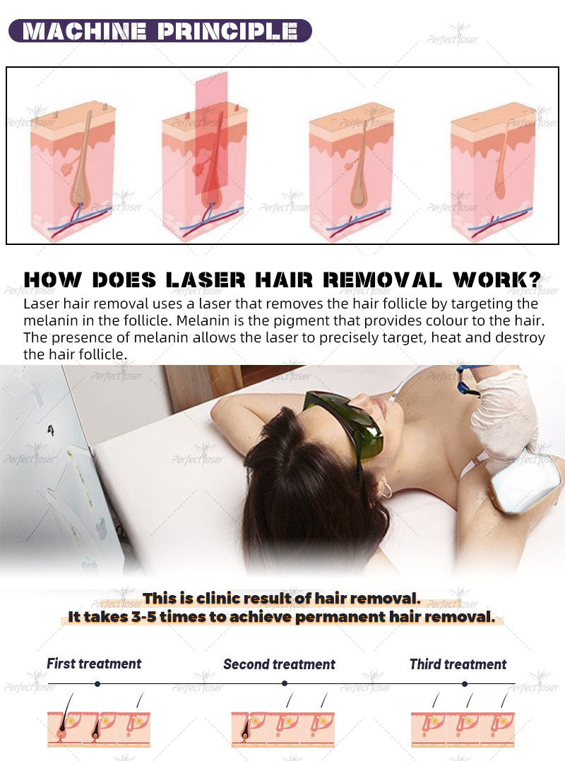 Water Air Semiconductor Cooling 15.6 Inch Color Touch Screen Diode Laser Hair Removal Machine -42 Cellulite