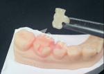 Emax Ceramic Inlays Onlays Dental Restorations For Natural Tooth Color And Easy