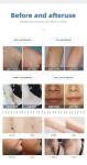 2 In 1 Diode Laser Hair Removal And Picosecond Laser Tattoo Remove Beauty