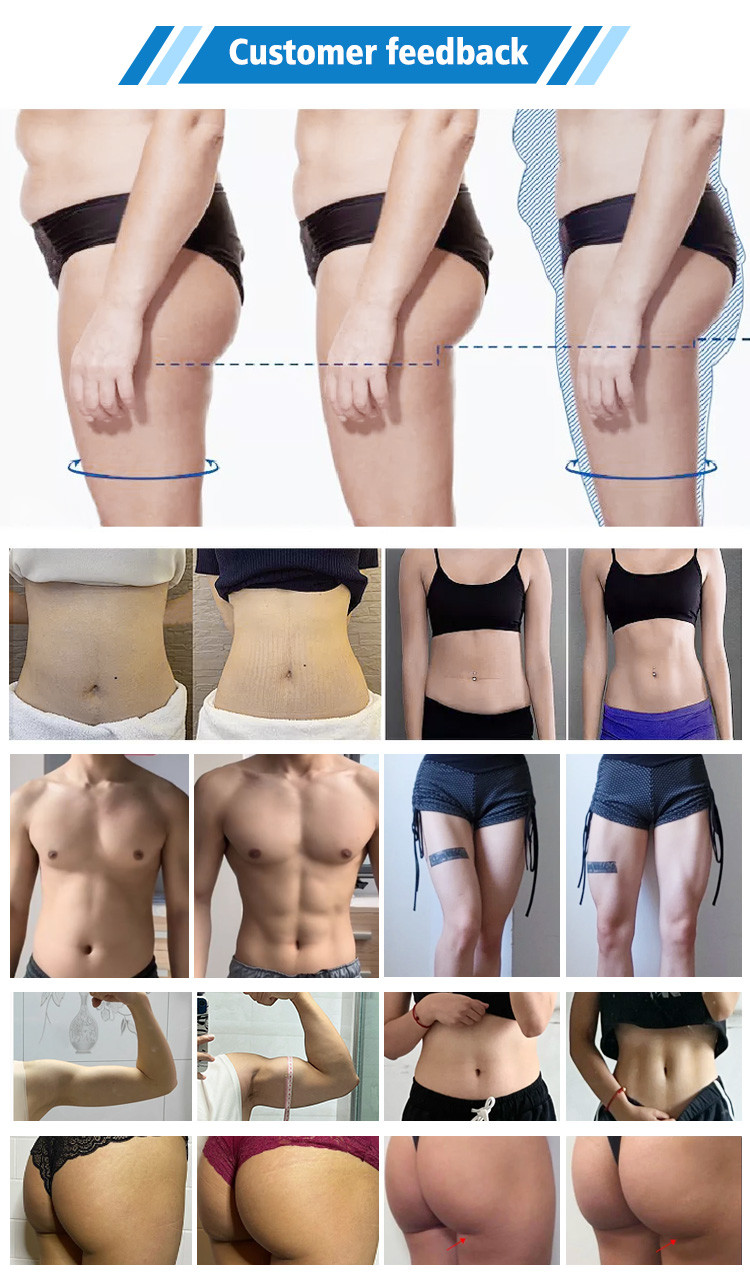 Non Invasive Body Shaping Slimming Machine 50Hz 60Hz EMS Fat Burning Machine