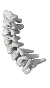 China ISO PEEK Spinal Fusion Cage Degenerative Disc Disease Cervical Fusion Cage factory