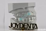 Custom Fitting Sleeping Aid Mouthpieces Dental Appliance To Stop Snoring