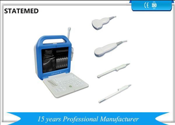 Hospital Laptop Ultrasound Scanner , 240 MM Scanning Depth Portable Ultrasound