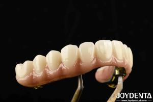 China Durable Ti-Bar Zirconia Hybrid Bridge Made Of Titanium And Zirconia Materials For Heavy Us factory