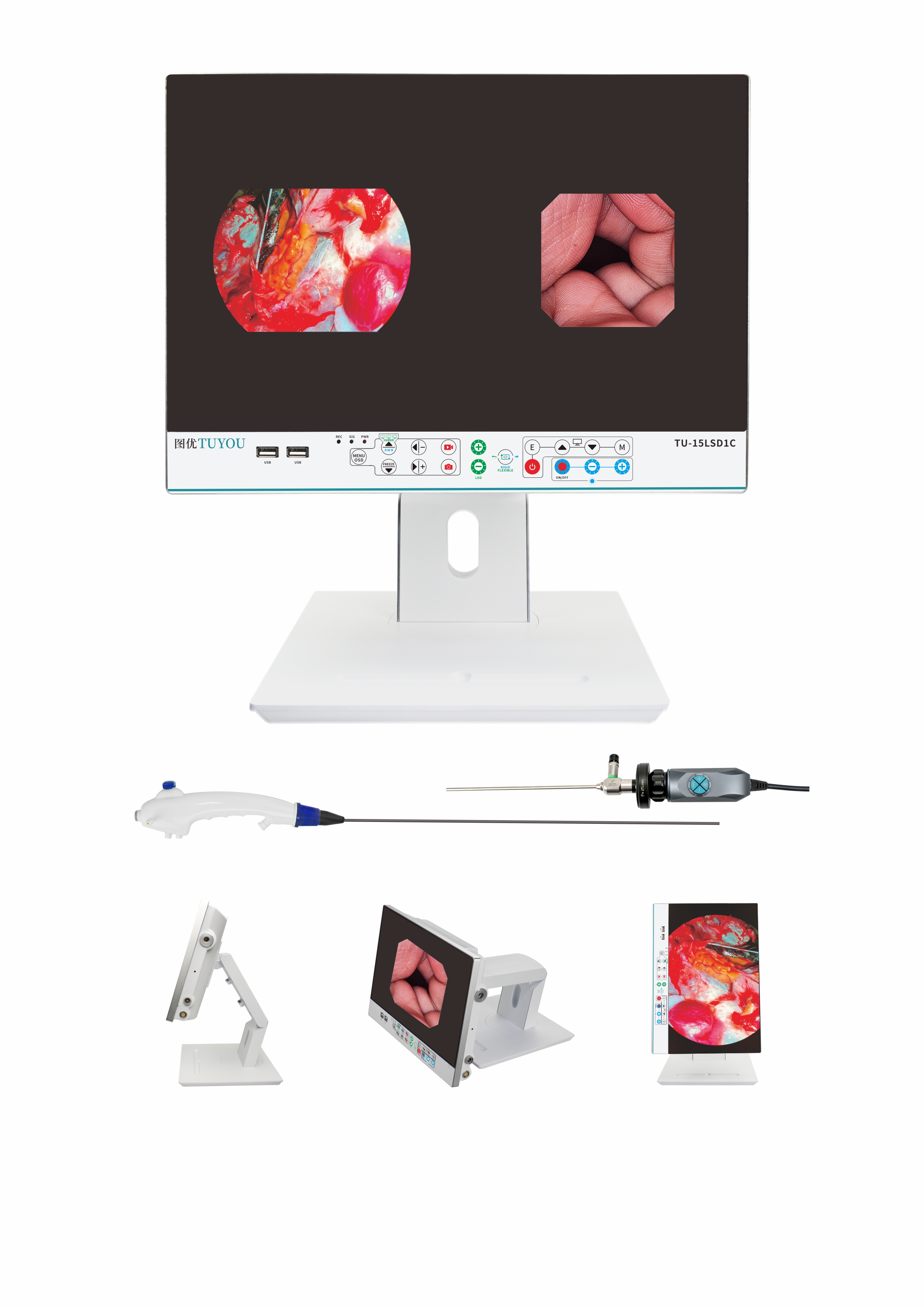 Medical medical full HD endoscope camera with LCD medical monitor Endoscopic Camera Video Endoscope System with 80W Ligh