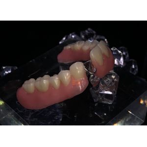 Openresty Server Software Based Metal Framework Partial Dentures Featuring