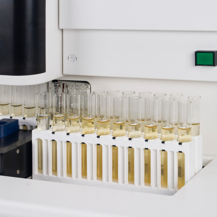 Biochemical Laboratory Medical Equipment Automated Urine Microscopy Analyzer 200 Strips