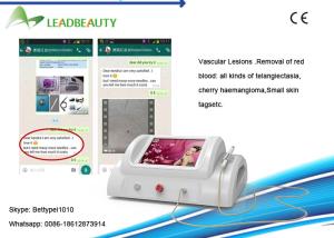 China Promotion! RBS Spider Veins Removal /Vascular Lesions Treatment factory