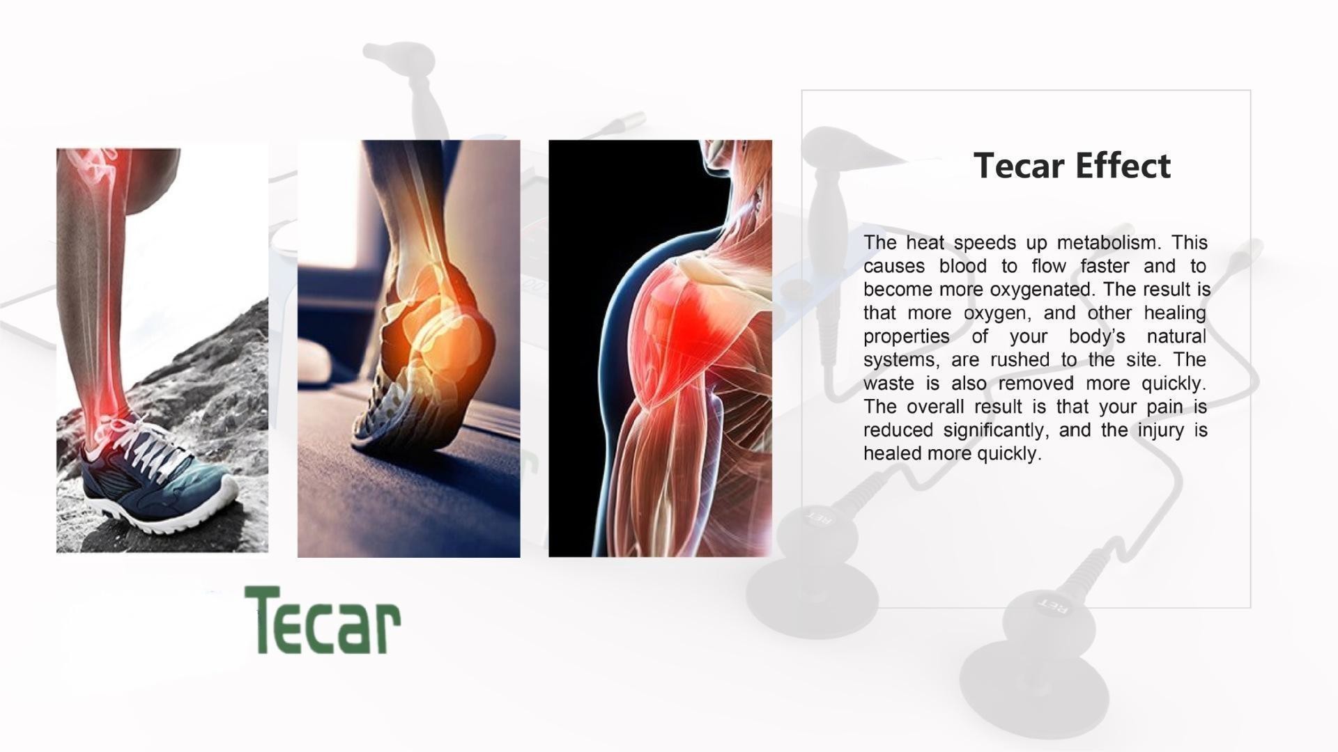 300KHZ - 500KHZ Tecar Therapy Machine CET / RET Radio Frequency Therapy Device