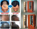 hair treatment Hair Growth Essence anti hair Loss Liquid dense unix hair