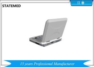 China Medical Multi Language Portable Ultrasound Scanner Pregnancy Test Ultrasound factory