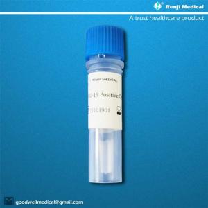 China COVID-19 Novel Coronavirus Test Kit high capacity testing MA YBTC approval factory
