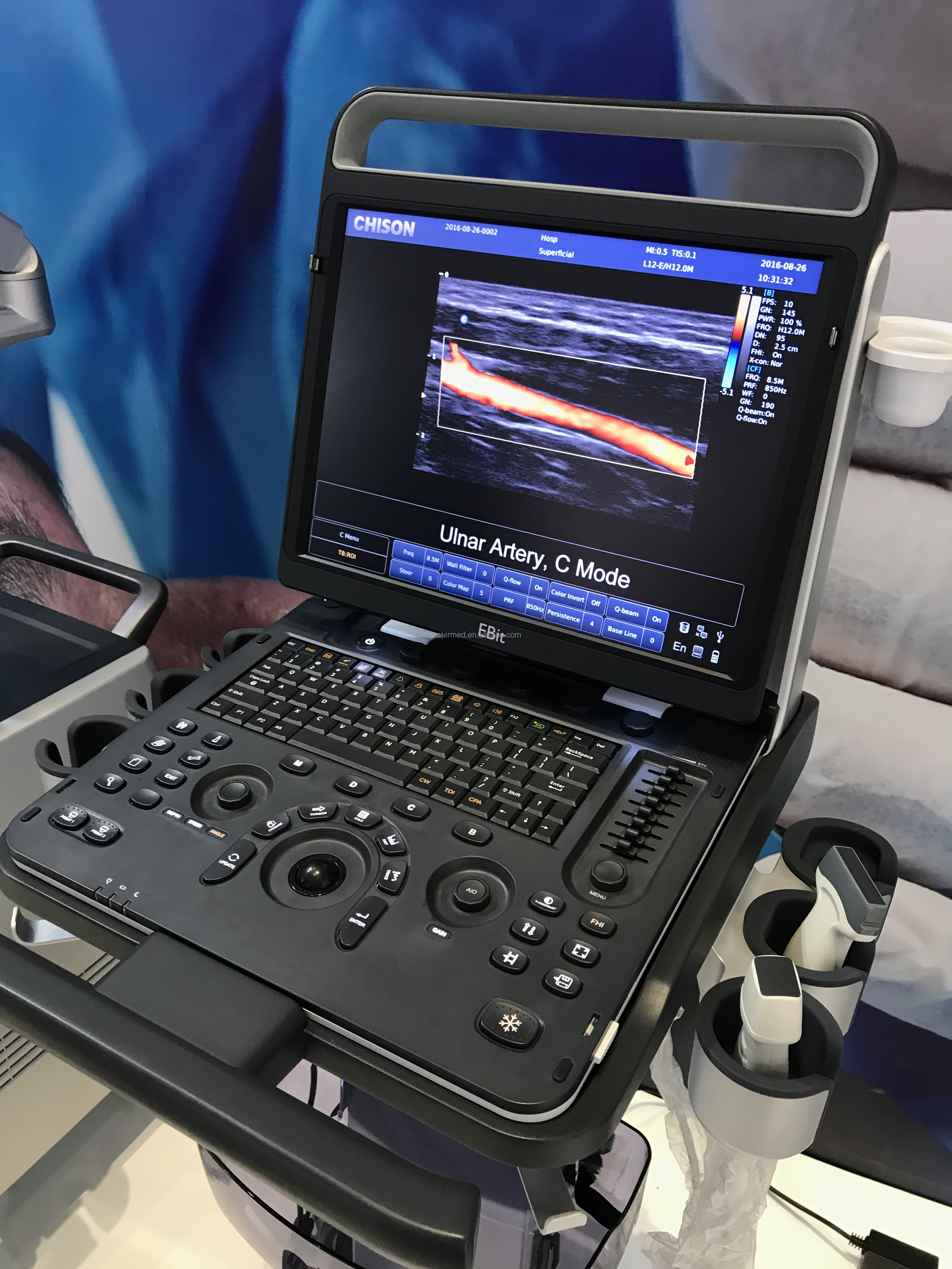 Portable 3D 4D Color Doppler USG&Sonoscape S9