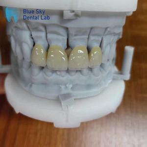 China Durable Zirconia Layered With Porcelain Zirconia Multilayer Crown factory