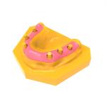 Professional Gum Resin For Implantology And Restorative Dentist