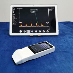 China Wireless Ultrasound Tranducer Android Color Doppler Ultrasound Probe Wireless Charging factory