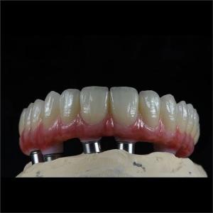 China ODM Full Arch Zirconia Implants Bridge Zirconium Implants Holistic Dentistry factory