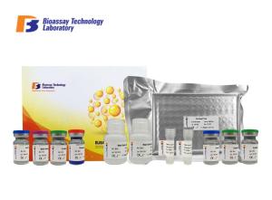 China High Sensitive Sandwich ELISA Kit Parkinson Disease Protein 2 For Human With Oem Service factory