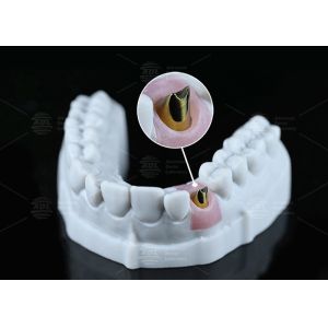 Internal Hex Custom Titanium Abutment Screw Cement Retained Varying Shape