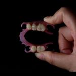 Lightweight Flexible Valplast Partial Denture For Single Tooth