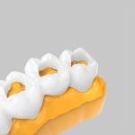 Special coating flexible transparent glaze on the surface of dental 3D printing