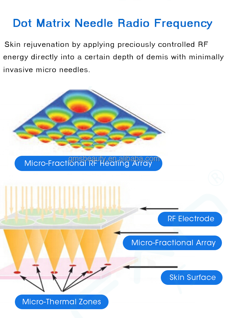 Microneedle RF White (7).png