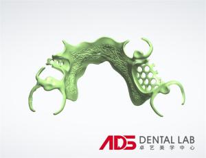 China ADS Dental Lab Partial Metal Frame Denture Framework Fabrication factory