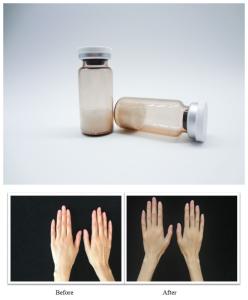 China Injectable PLLA Hyaluronic Acid pCL PDRN Facial Dermal Filler For collagen production Wrinkle Treatment factory