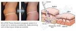 Liposuction Cavitation Slimming Machine Power Assisted