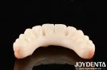 High Transparency Dental PMMA M75 For Aesthetic And Scratch Resistant Restoratio