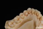 3D Multi Layer Dental Full Zirconia Chipping Resistance Natural Tooth Structure