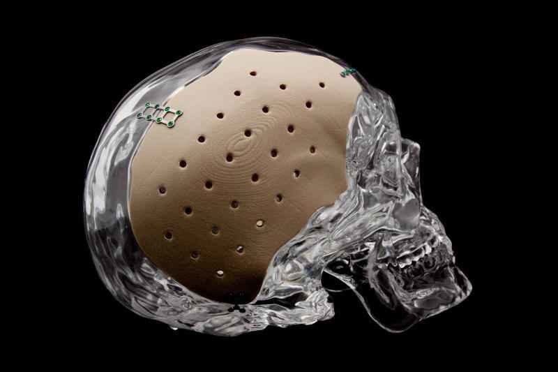 Standard Medical Injection Molding Parts with Ergonomic Design – Precision,