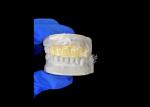 Lightweight Biocompatible 3D Printed Hollow Temporary Bridge for Pre Implant