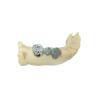 Buy cheap Customized Digital All Metal FCC crowns & bridges Nickel Chromium from wholesalers