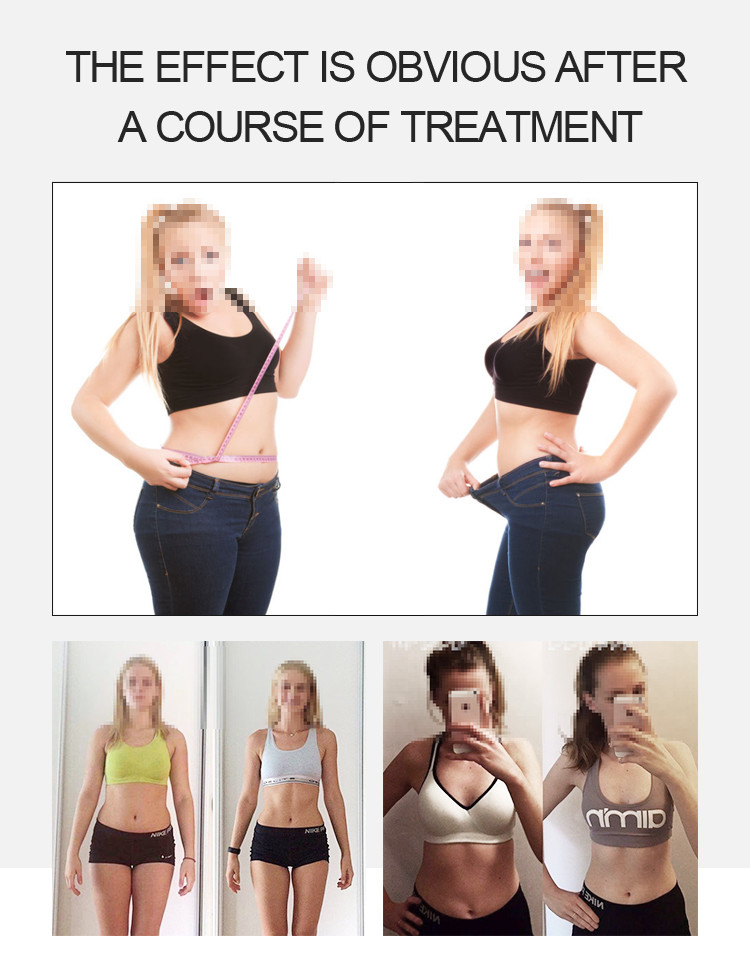 Pain Free Non Invasive Body Sculpting Device 635nm Laser Beauty Equipment