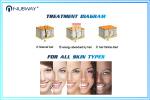 10 Laser bars Strong Power 808nm Diode Laser Hair Removal Machine