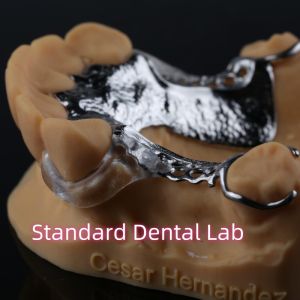 Laser Printing Cobalt Chrome Partial Denture With Clear Clasps