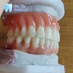 Naturally Full Denture Acrylic Removable Full Dentures Customizable